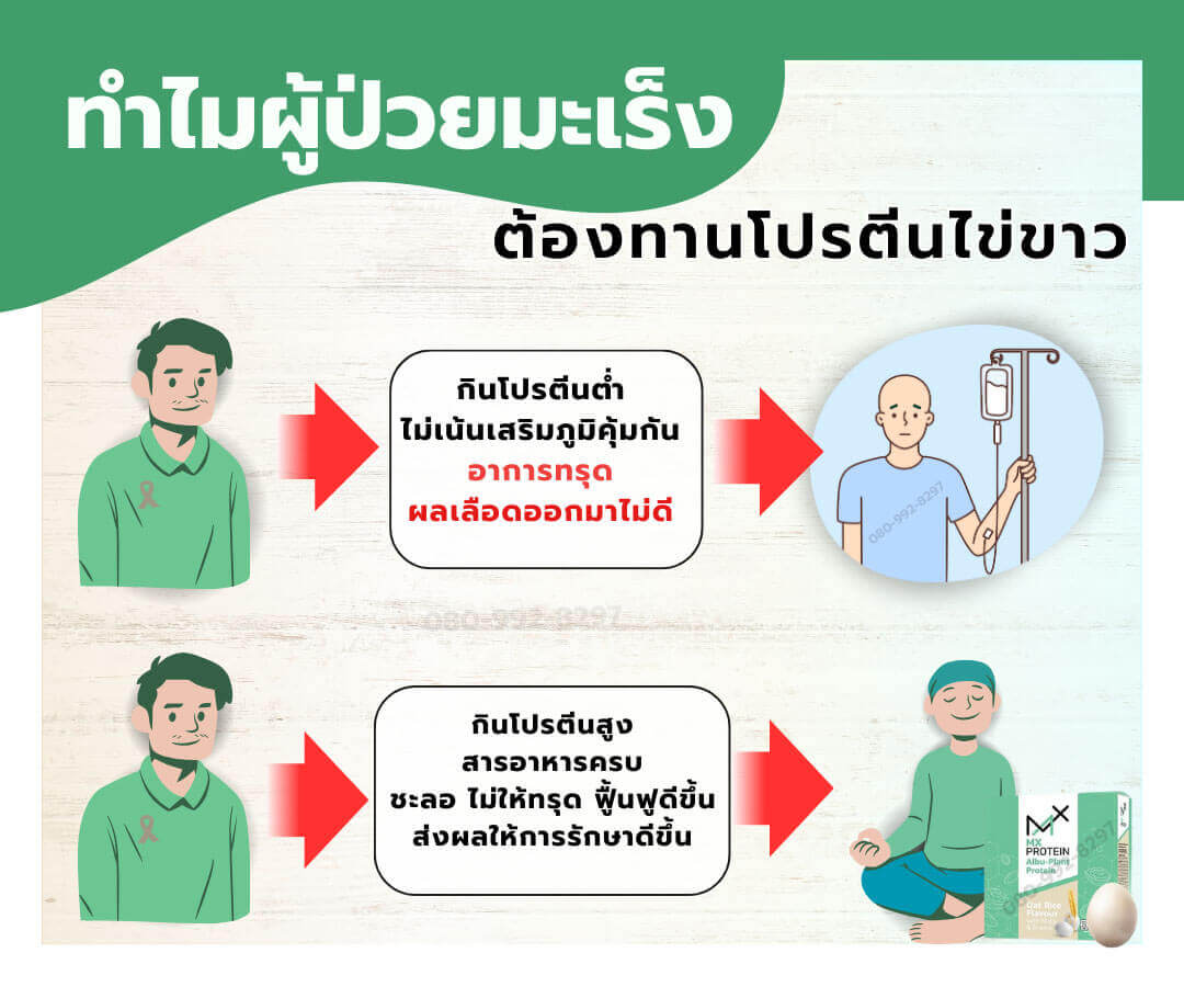 MxProtein โปรตีนผู้ป่วยมะเร็ง ทำไมผู้ป่วย ควรเสริมโปรตีน / MX Protein โปรตีนจากไข่ขาว