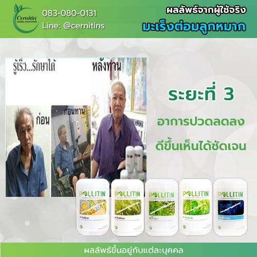 มะเร็งต่อมลูกหมาก ยารักษามะเร็ง